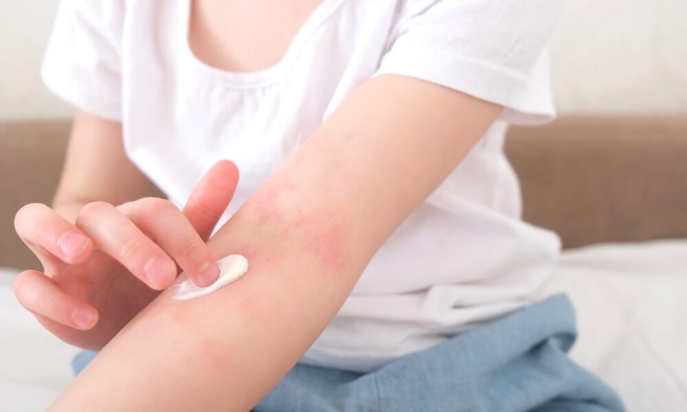 penyebab keterkaitan