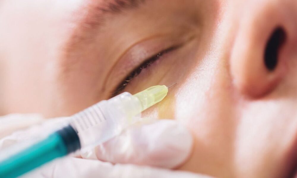 Manfaat dan Hal-Hal yang Perlu Diperhatikan dalam Treatment Collagen Stimulator