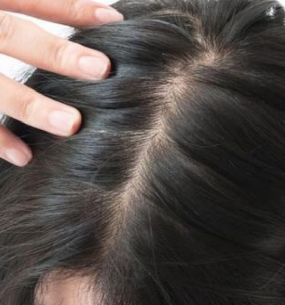 gambar rambut yang sehat