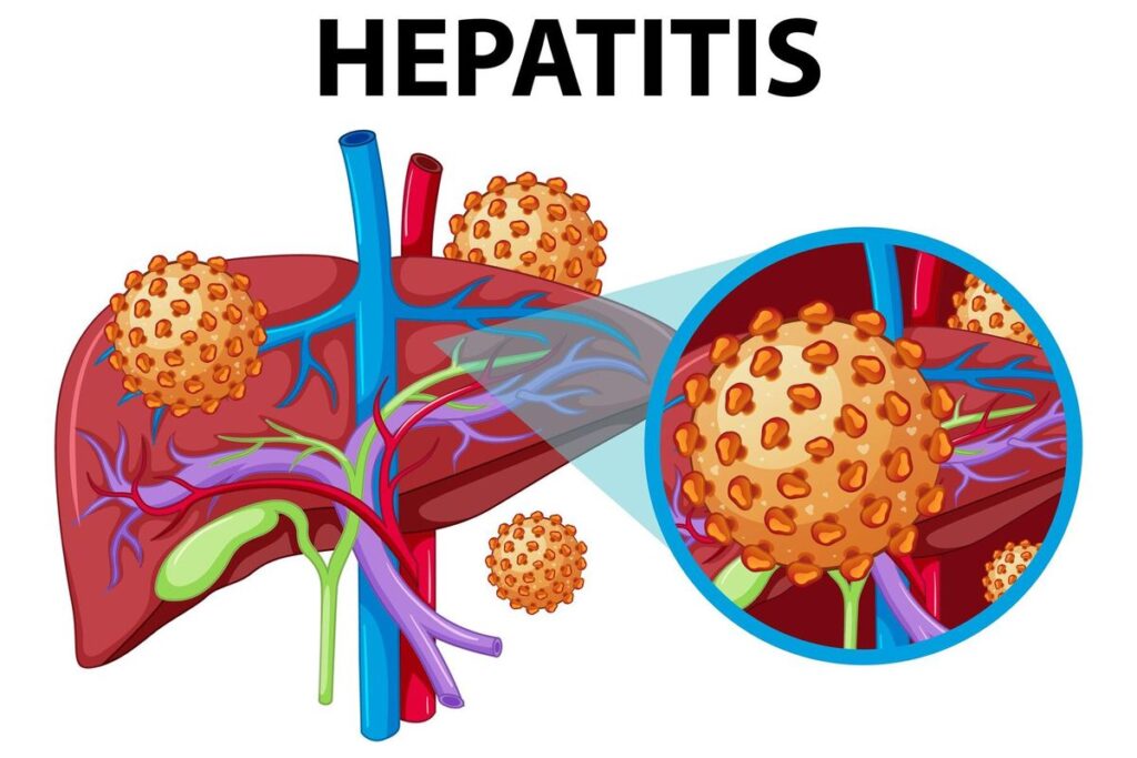 Hari Hepatitis Sedunia